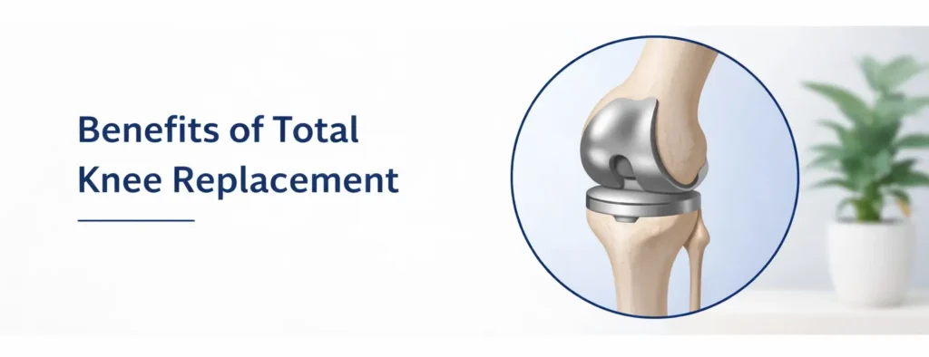 Benefits of Total Knee Replacement